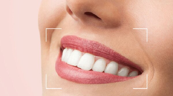 همه‌چیز درباره لبخندهای هالیوودی
