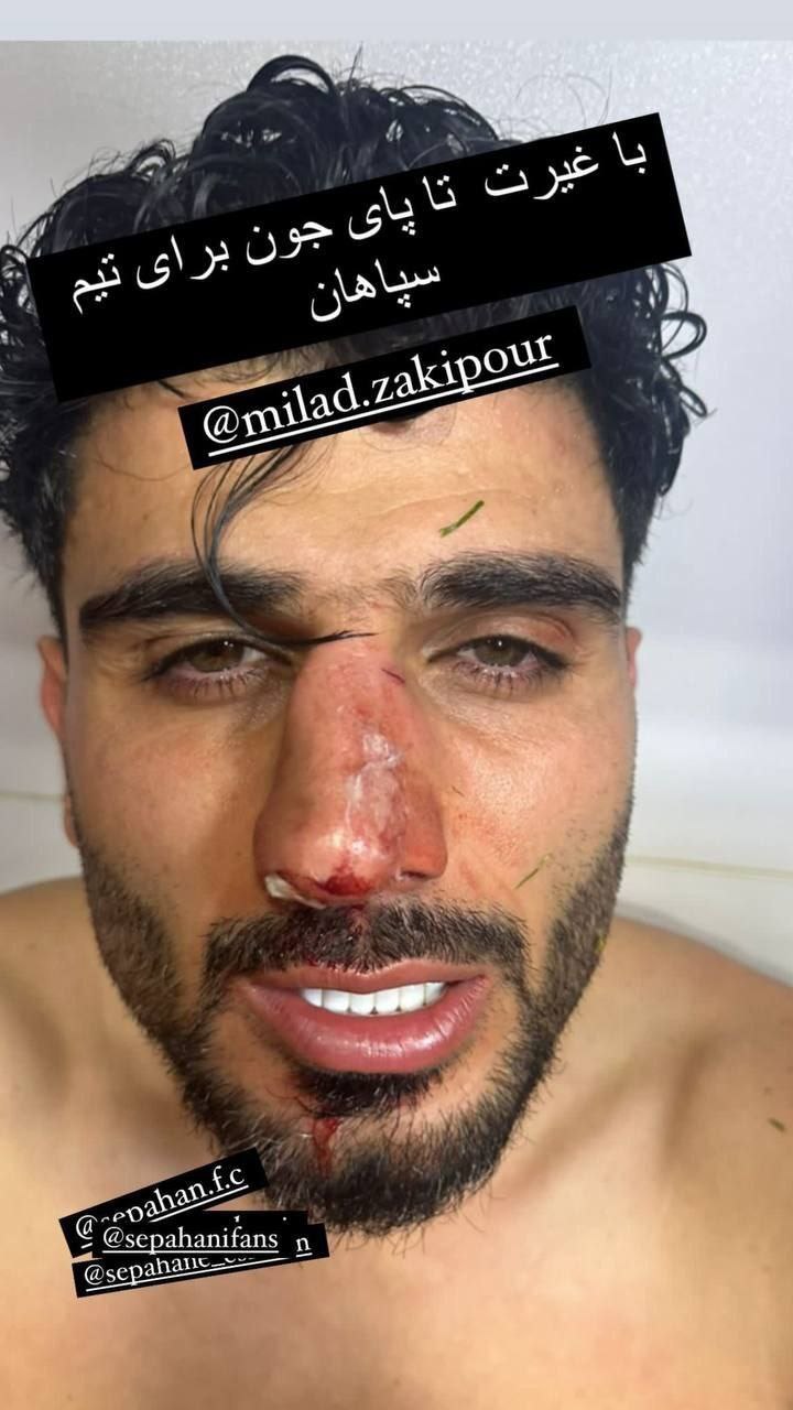 جراحت دلخراش زکی پور در بازی با استقلال خوزستان (عکس) 